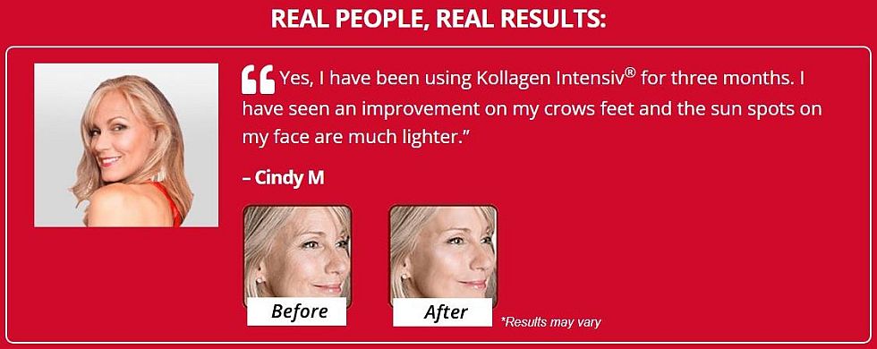 Kollagen Intensiv™