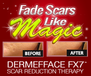 Scar Reduction Therapy