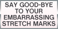 Skinception™ Intensive Stretch Mark Therapy