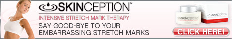 Skinception™ Intensive Stretch Mark Therapy